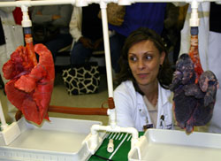 Dr. Espinoza with healthy and cancerous human lungs